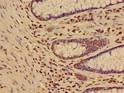 HIST1H3A Antibody