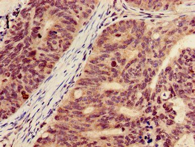 HIST1H3A Antibody