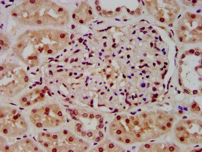 HIST1H3A Antibody