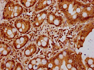 HIST1H3A Antibody