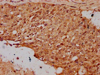 HIST1H3A Antibody