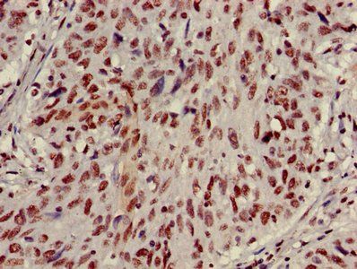 HIST1H3A Antibody