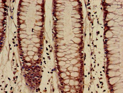 HIST1H3A Antibody