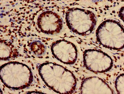 HIST1H3A Antibody