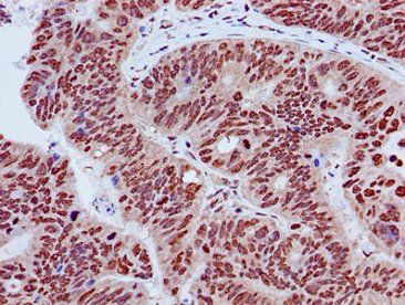 HIST1H3A Antibody