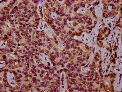 HIST1H3A Antibody