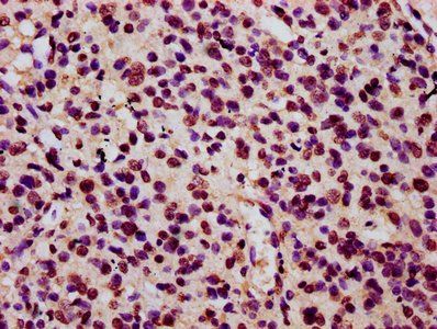 HIST1H3A Antibody