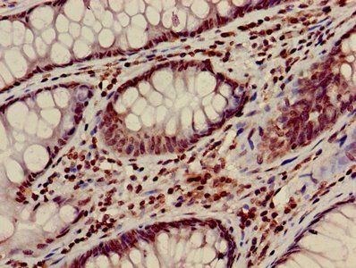 HIST1H3A Antibody