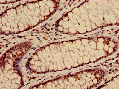 HIST1H3A Antibody
