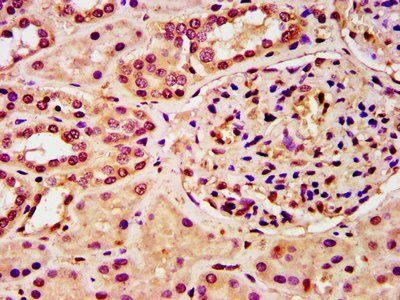 HIST1H3A Antibody