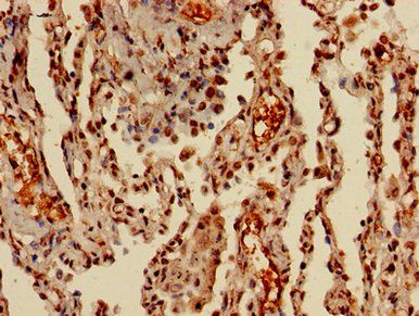 HIST1H3A Antibody