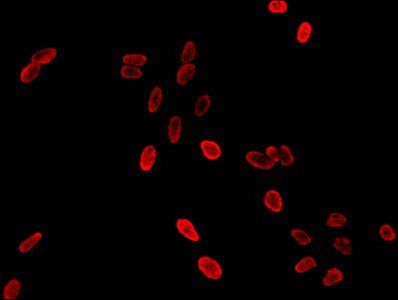 HIST1H3A Antibody
