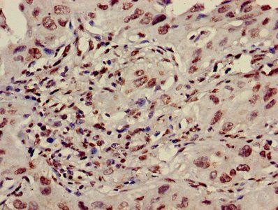 HIST1H3A Antibody