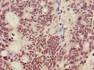 HIST1H3A Antibody