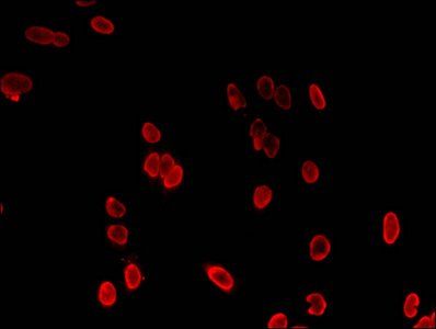 HIST1H3A Antibody