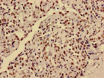 HIST1H3A Antibody