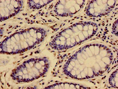 HIST1H3A Antibody