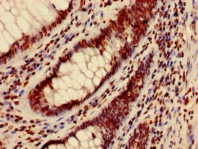 HIST1H3A Antibody