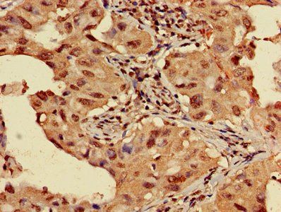 HIST1H3A Antibody