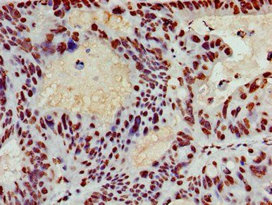 HIST1H3A Antibody