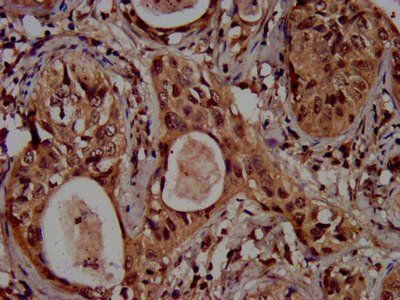 HIST1H3A Antibody
