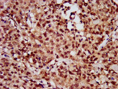 HIST1H3A Antibody