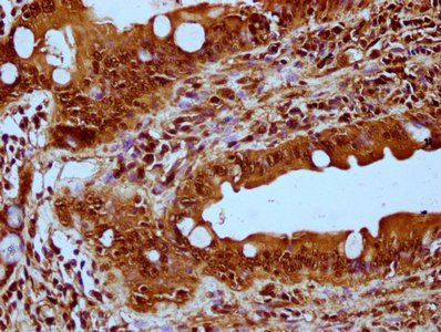 HIST1H3A Antibody