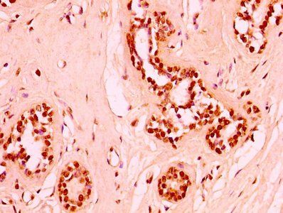 HIST1H3A Antibody