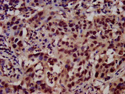 HIST1H3A Antibody