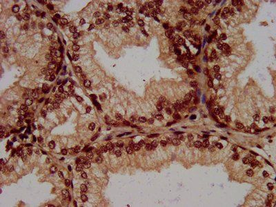 HIST1H3A Antibody