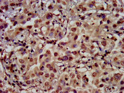HIST1H3A Antibody