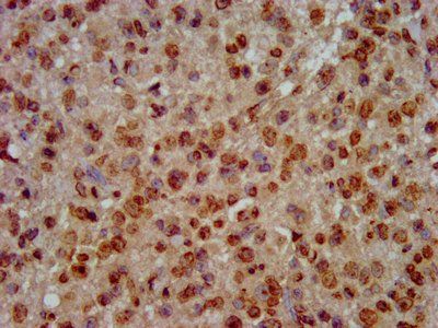 HIST1H3A Antibody