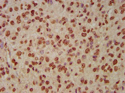 HIST1H3A Antibody