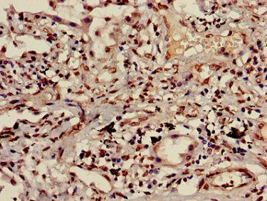 HIST1H3A Antibody