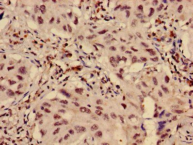 HIST1H3A Antibody