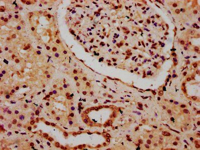 HIST1H3A Antibody