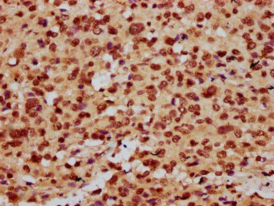 HIST1H3A Antibody