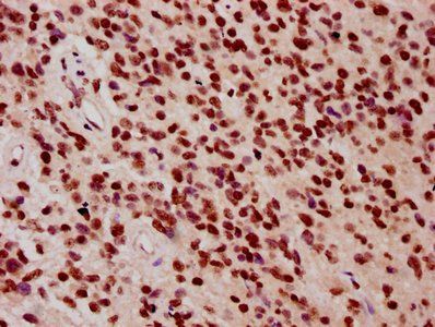 HIST1H3A Antibody