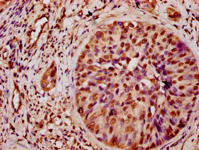 HIST1H3A Antibody