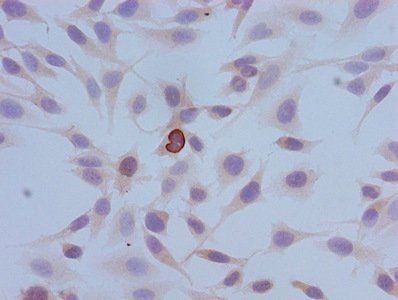 HIST1H3A Antibody