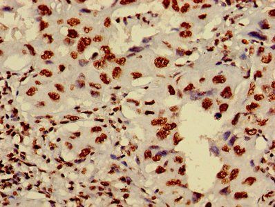 HIST1H4A Antibody