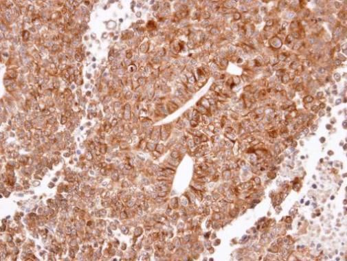 histamine receptor H2 Antibody