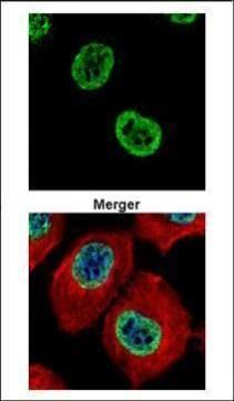 Histone H2A.Z Rabbit Polyclonal Antibody