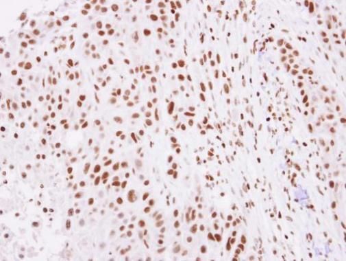 Histone H2A.Z Rabbit Polyclonal Antibody