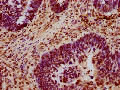 HIST1H3A Antibody