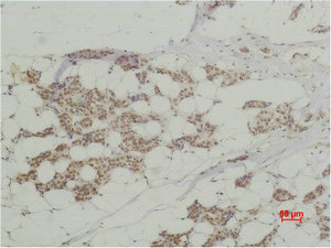 HIST1H3A Antibody