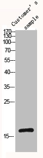 HIST1H3A/HIST2H3A/H3F3A Antibody
