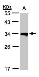 DIAPH1 Rabbit Polyclonal Antibody
