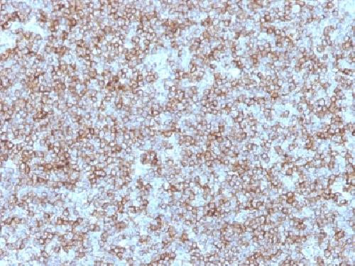 HLA-DPB1 Antibody