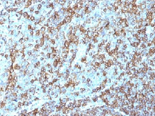 HLA-DRB1 Antibody